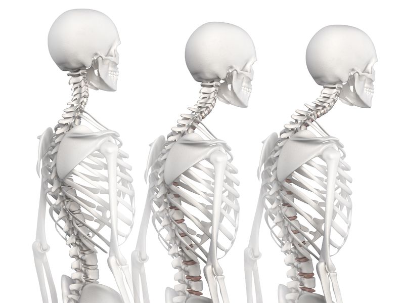 How-Tor-Improve-Posture-Toronto-Chiropractor